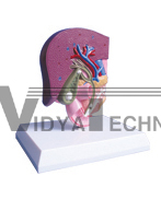 The dissection model of cholecystis calculus